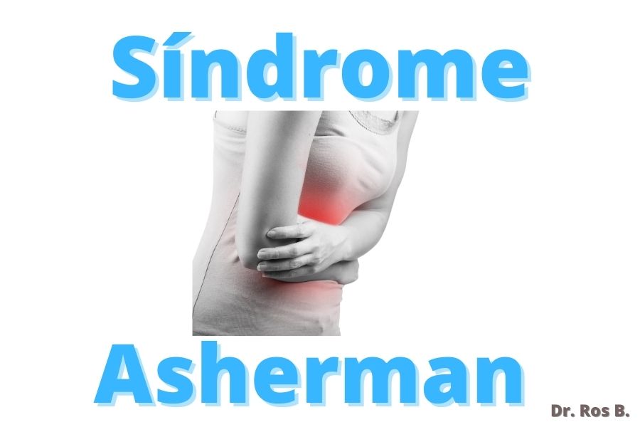 sindrome de asherman o adherencias uterinas